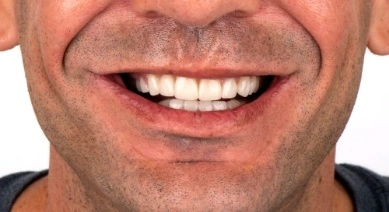 Close up image of a patient with a beautiful smile after getting his smile restored with dental implants.